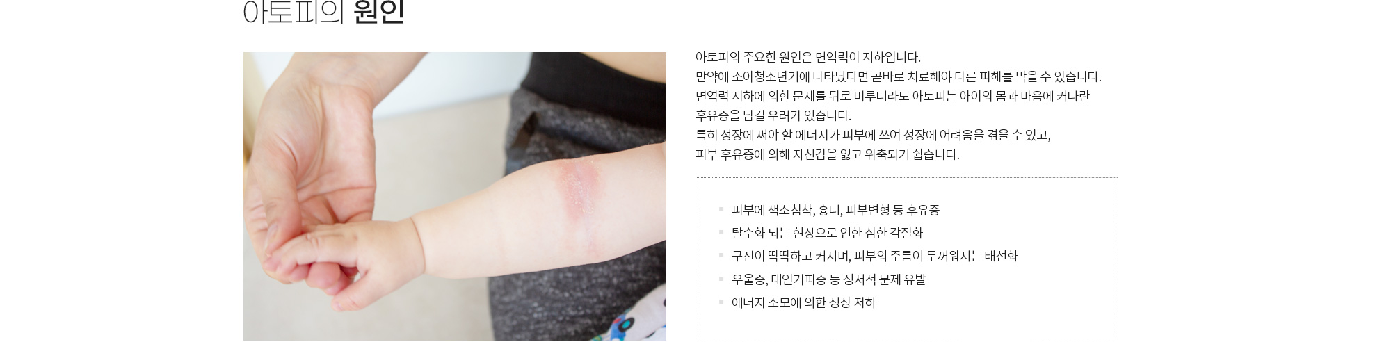 아토피·여드름·습진 상세 이미지 3