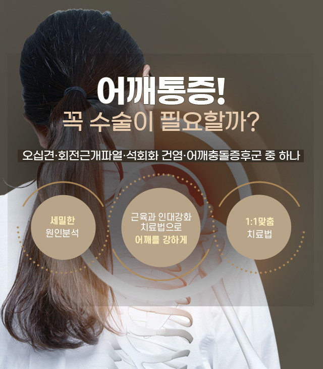 어깨관절 치료